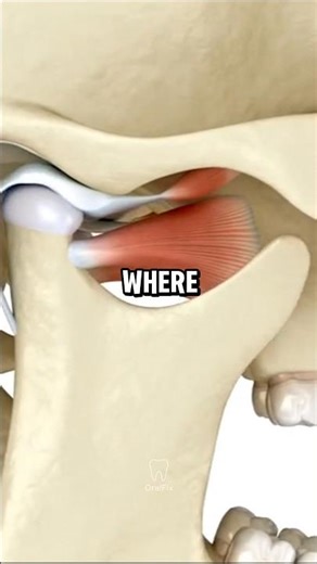 The Real Reason Your Jaw Hurts 😬 #dentist