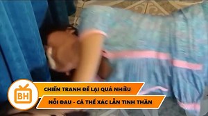 1.3M views · 80 shares | Chiến tranh đã kết thúc nhưng hậu quả của nó để lại quá nặng nề Xem phim tại: https://youtu.be/MyhU6DJsGX0 - -- | Công Lý | Facebook