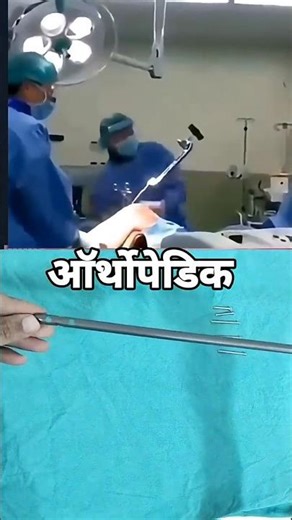 Leg frectur 🦾🔨 #TibiaNail#TibiaFracture#OrthopedicSurgery#BoneFracture