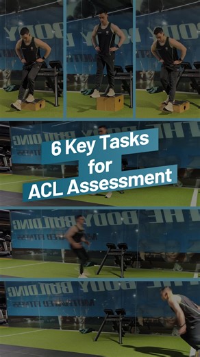 🦵 Can these exercises 2D video analysis help predict second ACL injuries? 📊 In female athletes returning to sport after ACL reconstruction, higher-risk movement patterns across tasks like step downs, decelerations, and drop jumps were associated with increased odds of a secondary ACL injury. 🎥 This video highlights the same dynamic assessments used in the study, showing how simple 2D video can capture meaningful movement quality beyond strength and hop tests alone. 👉 See how Dr Travis Pollen