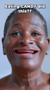 4K views · 25 reactions | 樂醴 How Did Eating Candy Do THIS To Her...