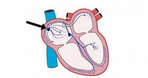 Cardiac Conduction System – TeachPE.com