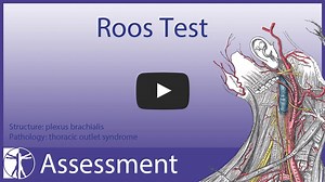 THORACIC OUTLET SYNDROME ASSESSMENT SERIES PART 2: ROOS TEST The Roos test has a sensitivity of 84% and a specificity of 30% (Gillard et al. 2001) and stresses all three interfaces (posterior scalene port, costoclavicular space and subcoracoid tunnel) where the brachial plexus can become compressed. (Watson et al. 2010). | Physiotutors