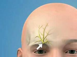 Nerve Blocks Face (sample) - www.proceduresconsult.com