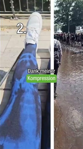 3 Dinge, die Betroffene wirklich über Kompression sagen