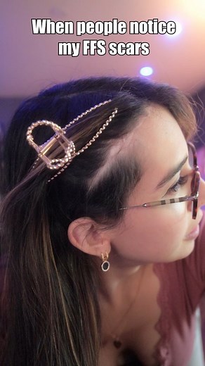 Evelyn Gonzalez on Instagram: "REAL NANO LORE?? 😳😳 . . . sometimes i just make shit up and say i got attacked by a shark or smth 🤭🤭🤭 . . . #mtf #transisbeautiful #cute #funny #relatable #memes #memesdaily #dailymemes #funnymemes #backstory #lore #feminization #trans #interesting #cool"