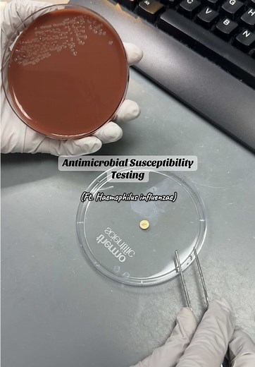 Did you know that H.influenzae commonly causes ear infections, pneumonia and sinusitis in infants and children? #microbiology #medtechtok #fyp