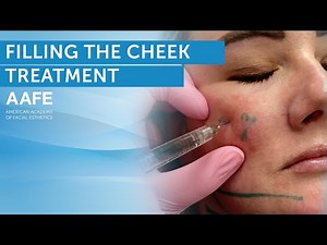 How To Mark And Fill The Cheek