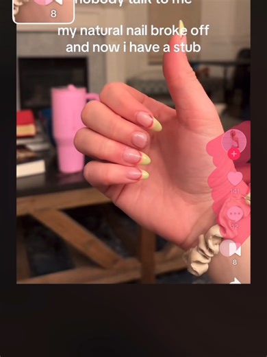 I use Magic Eraser app #magiceraser #photoediting #viral #trending #nails