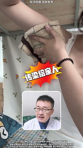 腋下臭臭的出汗多，白衣服经常被染黄？这可能不是狐臭，而是会传染的腋毛癣！腋毛癣腋臭狐臭抖出健康知识宝藏医学科普