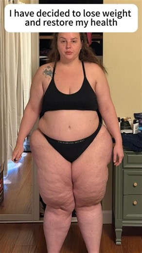 My Lipedema Journey: From Diagnosis to Strength & Healing 💪✨ #motivation