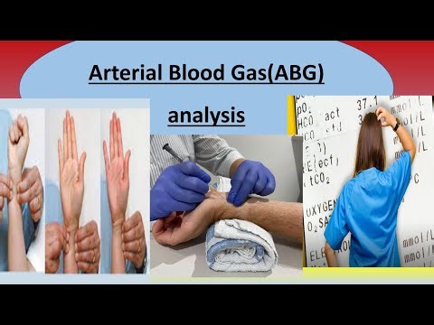 ABG analysis|| ABG sampling || How to interpret the ABG report||Part-II