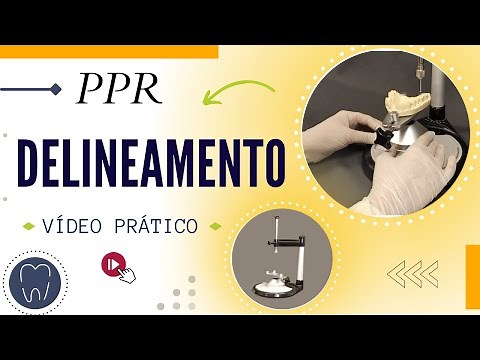 DELINEAMENTO PPR - Passos do planejamento