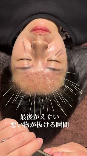 【眼精疲労】悪いもの抜ける瞬間