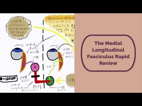 Medial Longitudinal Fasciculus Rapid Review