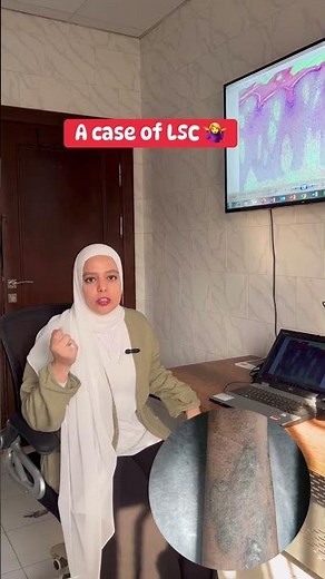 Lichen simplex chronicus #dermatology