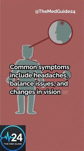 When fluid builds up in the brain… it’s not normal! ⚠️🧠