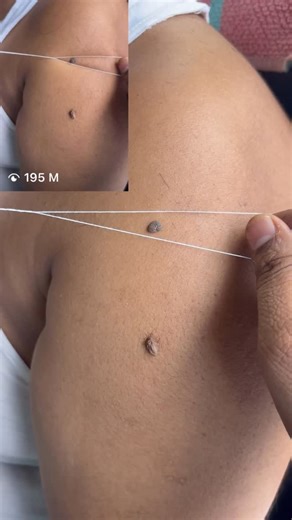 Jeetu mens salon on Instagram: "Massa kese nikale #massa by @jeetu_mens_salon #massage #massappeal #massadoption #massa #mässa #massamagra #massaartesanal #dot #kil #dots #reels #reelsinstagram #instagood #viral #foryou #love #instagram #tiktok"