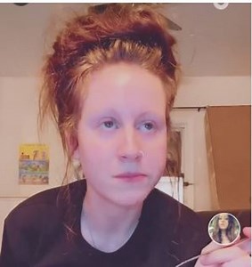 WATCH: Woman’s video of ‘squiggly white’ worms in her butt goes viral