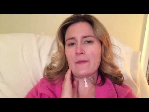 2 Weeks post op Cervical Artificial Disc Replacement: New and Old Symptoms