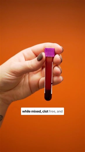 All-Star Veterinary Clinic on Instagram: "How to perform a manual platelet count in vet med! #veterinarian #vetmed #vettech #veterinarylife #vettechlife"