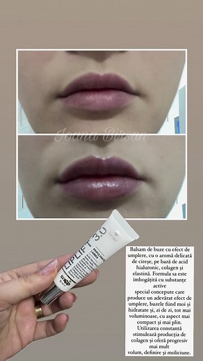 23K views · 147 reactions | Acid in buze? Rezultatul la final #acid #buze #acidhialuronic #plump #natural #brevetat #molecule #acidhialuronicinbuze #acidohialuronico #buzeletale | Ioana Birsan | Facebook
