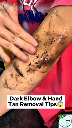 🔥 Dark Elbow & Hand Tan Removal Pack #skincare #shorts #viral #beauty #fyp #viralshorts #ytshorts