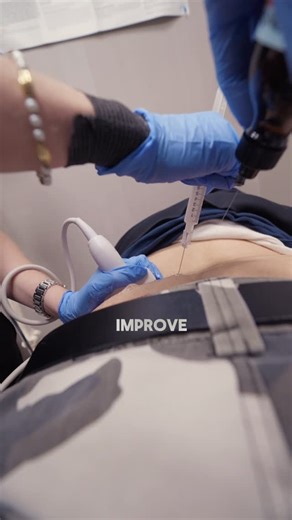 Precision Care Medical&Sports Performance on Instagram: "Trigger point injections are used to treat tight, painful knots in the lower back muscles that won’t relax on their own. These irritated spots can limit your movement, affect posture, and cause persistent discomfort. By injecting a small amount of medication directly into the trigger point, inflammation goes down, tension eases, and physical therapy becomes much more effective. #backpain #painmanagement #painrelief"