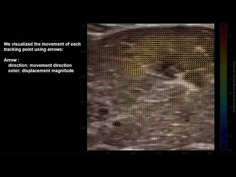 Fig.3: Vector Field Comparison and Directional Anisotropy