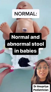 If you’re a new mom, you need to know this. Normal and abnormal stool in babies. #newborn #infant #stool #babystool #babystoolguide #babypoops #babypooping | Babynama