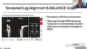 Robotic-Assisted Inverse Kinematic Alignment Simplified
