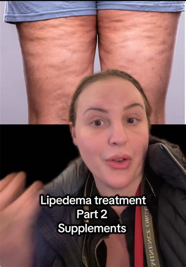 Lipedema Treatment Supplements: Essential Guide Part 2