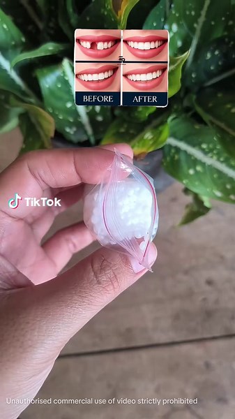 Tambalan gigi ompong gigi berlubang gigi patah gigi Palsu gigi gingsul DIY BEAD TEMPTOOTH lem butiran penambal serbaguna