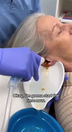 Essential Guide to Earwax Removal Tools