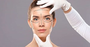 Feito no Brasil: lifting facial por vídeo sem corte ou cicatriz