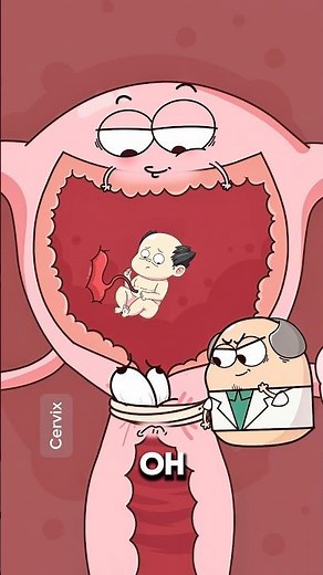 Why Some Moms Need Their Cervix Stitched Shut 🤰😳..!!#e2dhealth #animation #2dshow #health #foryou