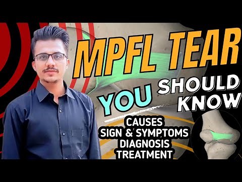 MPFL Tear | Medial Patellofemoral Ligament Tear | MPFL Injury | Patellar Dislocation|MPFL Exercises