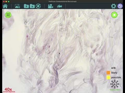 PathCAM with PathDino for fast AFB search