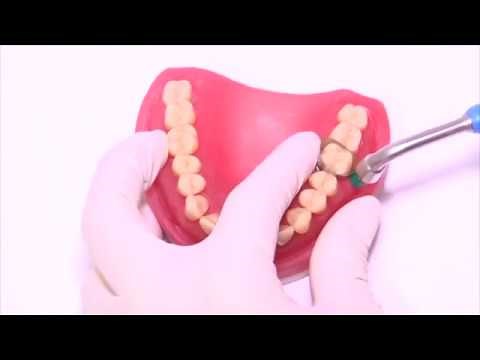 SuperMat: The Universal Matrix Tensioning System