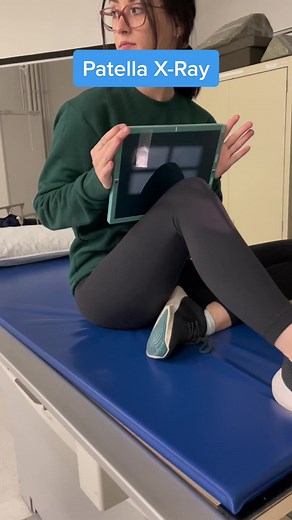 Patella X-Ray Imaging and Positioning Guide