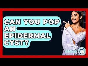 Can You Pop An Epidermal Cyst? - Skin Savvy Dermatology