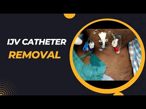 How to remove IJV (Jugular) catheter | Central line catheter removal |Dialysis catheter removal