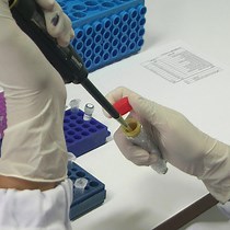 Reverse Transcription Loop-Mediated Isothermal Amplification (RT-LAMP) Assay for the Specific and Rapid Detection of Tilapia Lake Virus