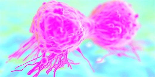 Personalized cancer treatments based on testing drugs quickly leads to faster treatment