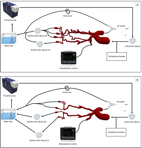 Impact of collateral flow on recanalization in different thrombectomy techniques - Scientific Reports