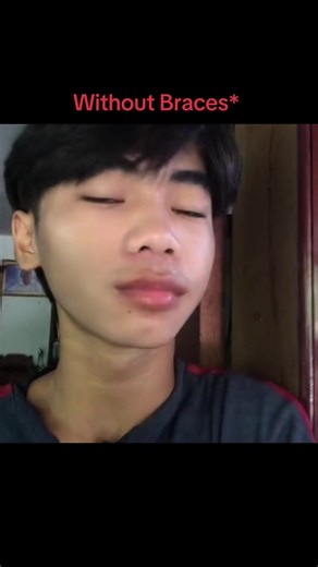 Without Braces Challenge: 5-10 Minute Tutorial for Neck Exercises