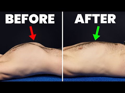 Fix Rib Flare FAST (In Less Than 5 Minutes a Day)