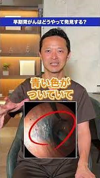 Inside the Stomach is Blue!? What is "Early-Stage Stomach Cancer" That’s Dangerous If Found? What...