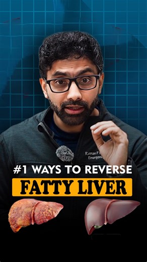 Reverse Fatty Liver Naturally