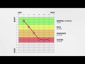 Hear.com - How to Read an Audiogram